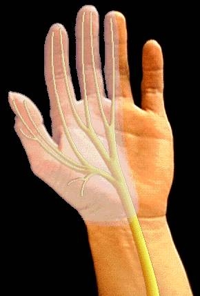 How to Naturally Rid Numbness in the Fingers (with Pictures) | eHow