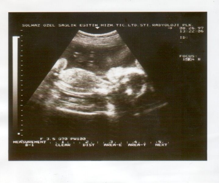 How to Read an Ultrasound of the Liver (with Pictures) eHow