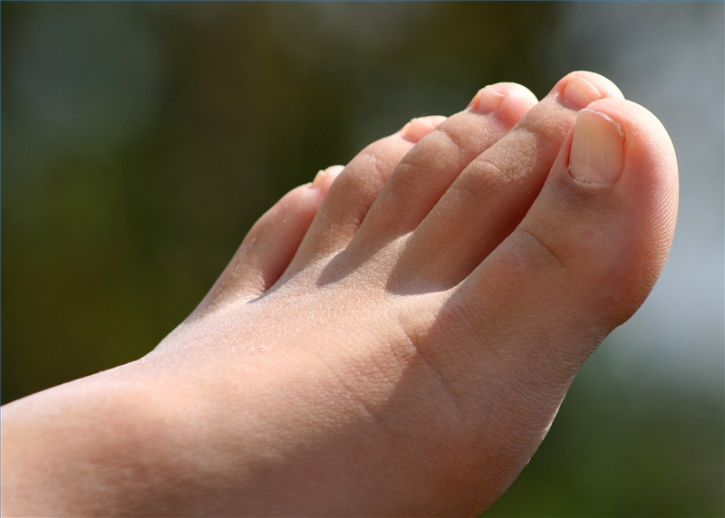 how-to-get-rid-of-foot-fungus-ehow